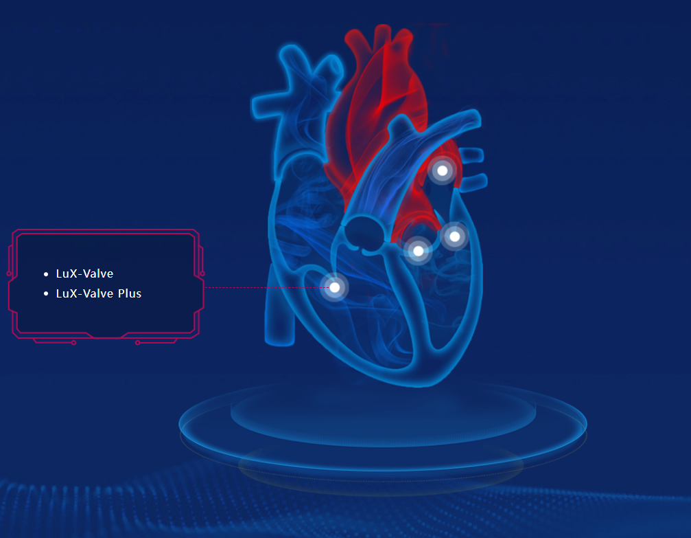 LuX-Valve Plus – Transcatheter Tricuspid Valve Interventional Treatment